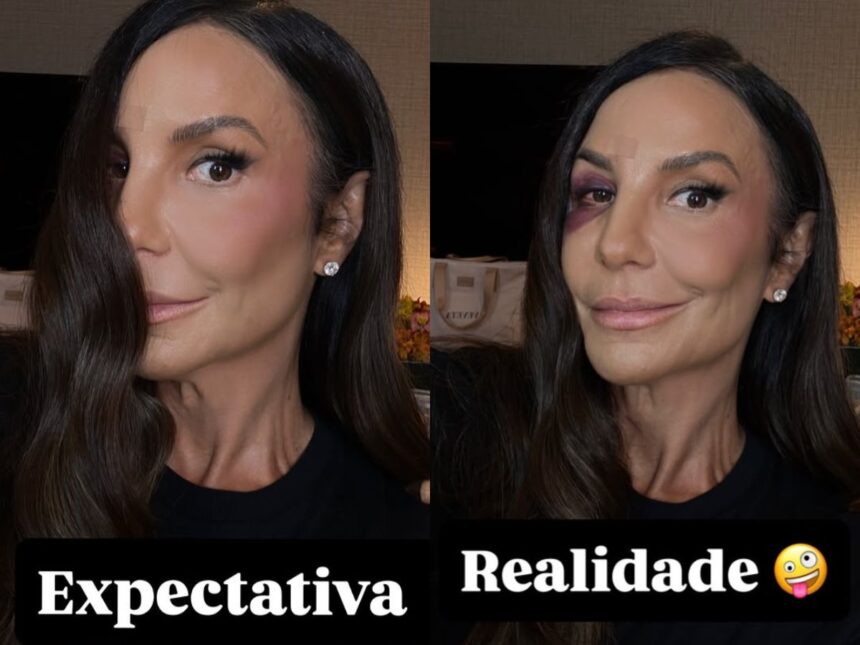 Após acidente doméstico, Ivete Sangalo retorna aos palcos com apresentação no Ibirapuera