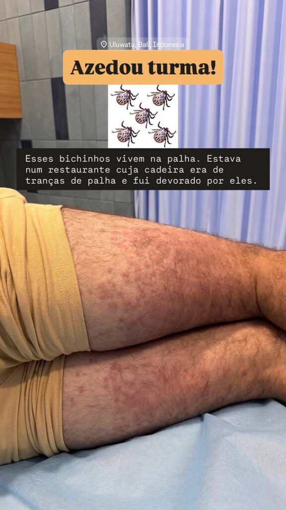 Coceira absurda: ataque de ácaros interna Lucas Malvacini